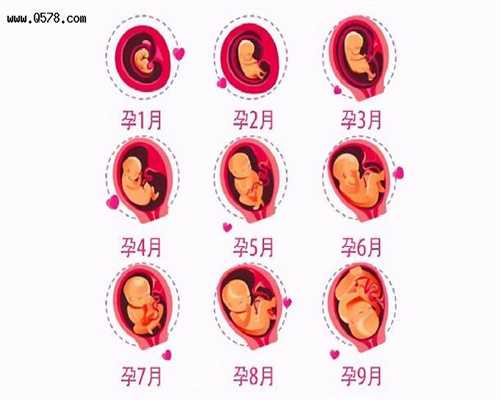 深圳助孕产子哪便宜_深圳代孕的流程是怎样的_环球宝贝最新情况_卵巢囊肿卵子